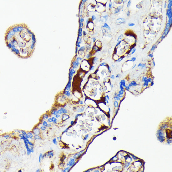 Transferrin Rabbit mAb