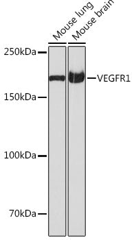 VEGFR1 Rabbit mAb