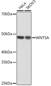 WNT5A Rabbit mAb