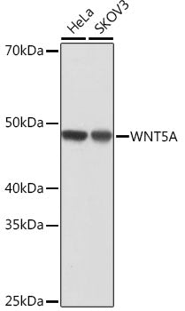 WNT5A Rabbit mAb