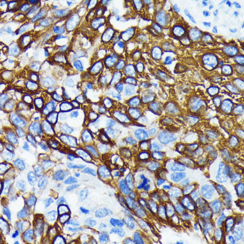 WNT5A Rabbit mAb