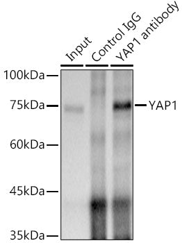 [KO Validated] YAP1 Rabbit mAb
