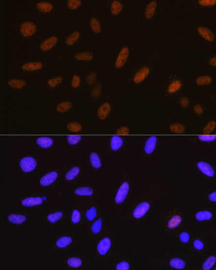 [KO Validated] YAP1 Rabbit mAb