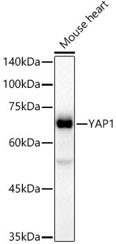[KO Validated] YAP1 Rabbit mAb
