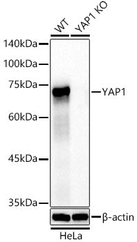 [KO Validated] YAP1 Rabbit mAb