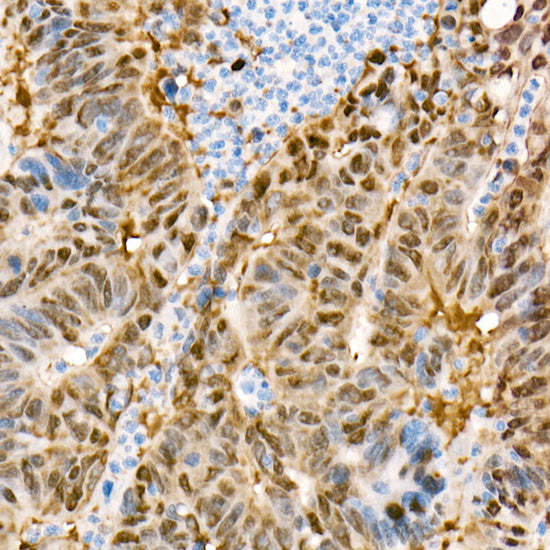 [KO Validated] YAP1 Rabbit mAb