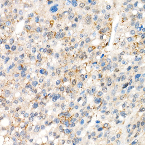 [KO Validated] YAP1 Rabbit mAb