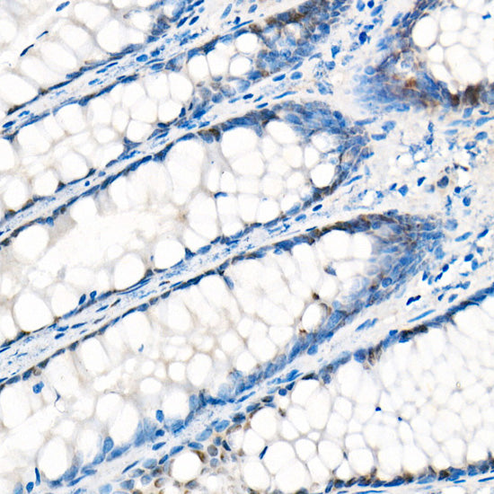 [KO Validated] YAP1 Rabbit mAb