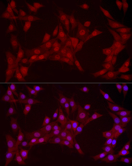 [KO Validated] YAP1 Rabbit mAb