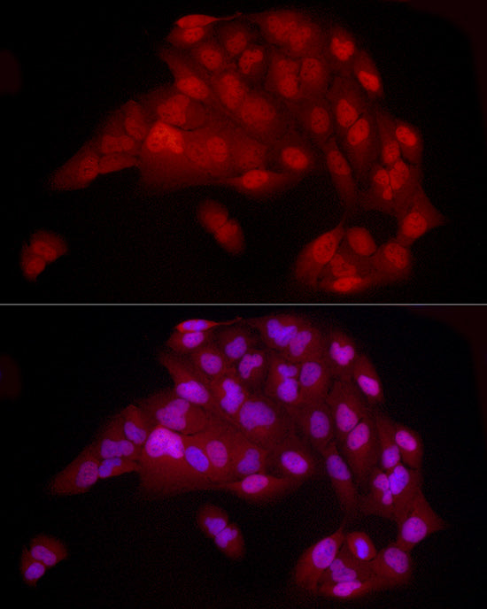 [KO Validated] YAP1 Rabbit mAb