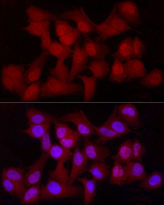 [KO Validated] YAP1 Rabbit mAb