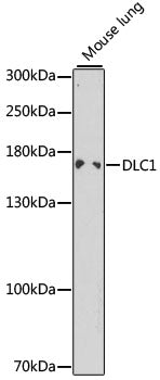 DLC1 Rabbit pAb