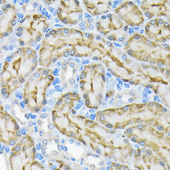 Glycerol kinase (GK) Rabbit mAb
