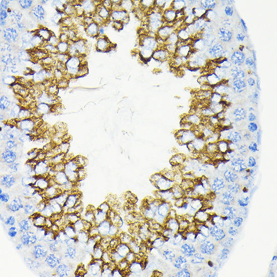 Glycerol kinase (GK) Rabbit mAb