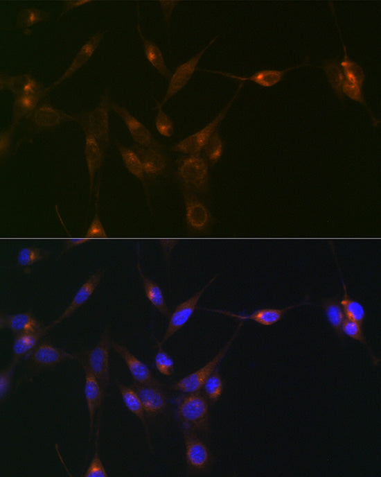 PDLIM1/CLP36 Rabbit mAb