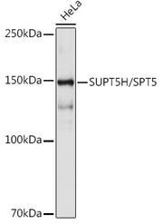 SUPT5H/SPT5 Rabbit mAb
