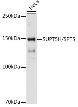 SUPT5H/SPT5 Rabbit mAb