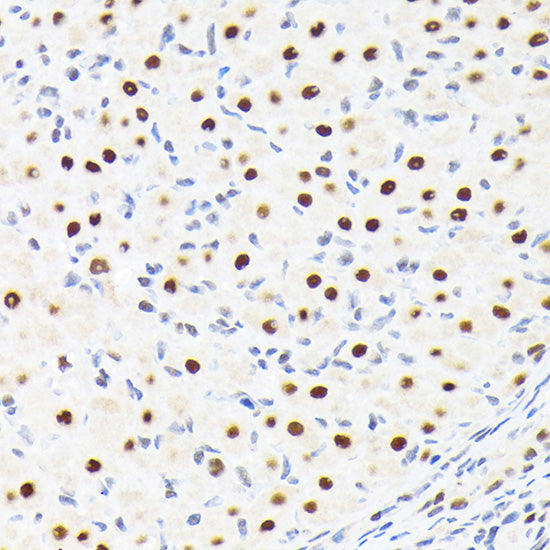 SUPT5H/SPT5 Rabbit mAb