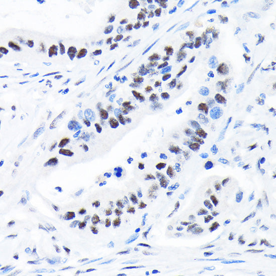 SUPT5H/SPT5 Rabbit mAb