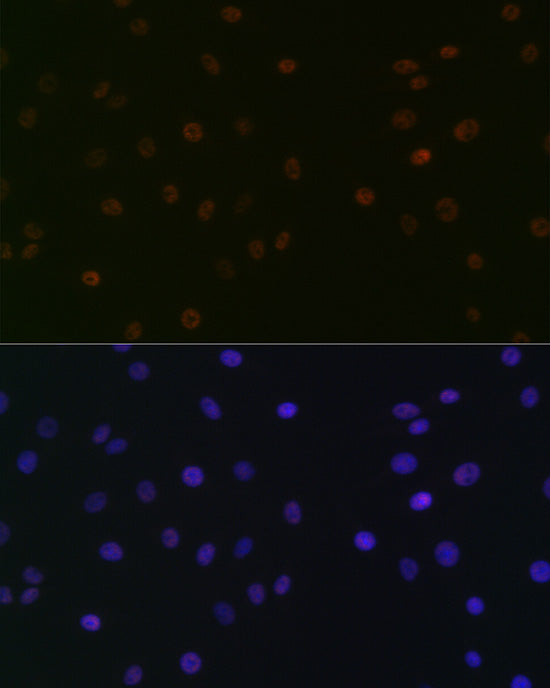 SUPT5H/SPT5 Rabbit mAb