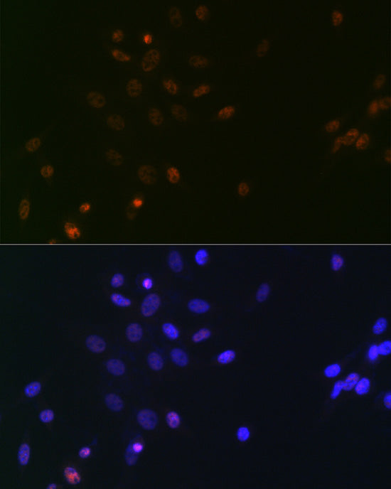 SUPT5H/SPT5 Rabbit mAb