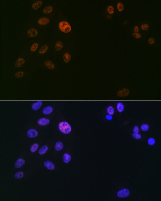 SUPT5H/SPT5 Rabbit mAb