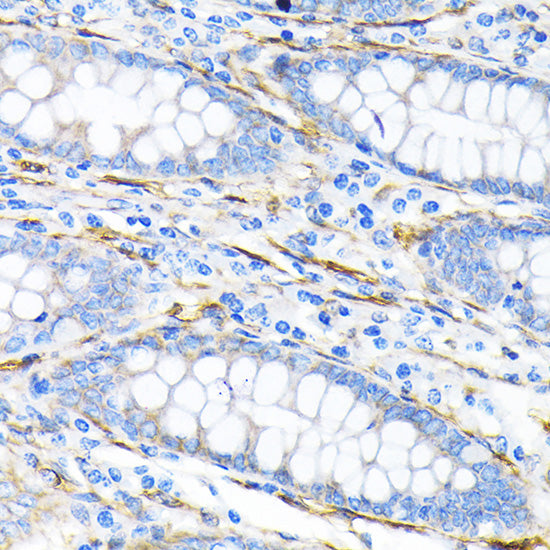 LPP Rabbit mAb