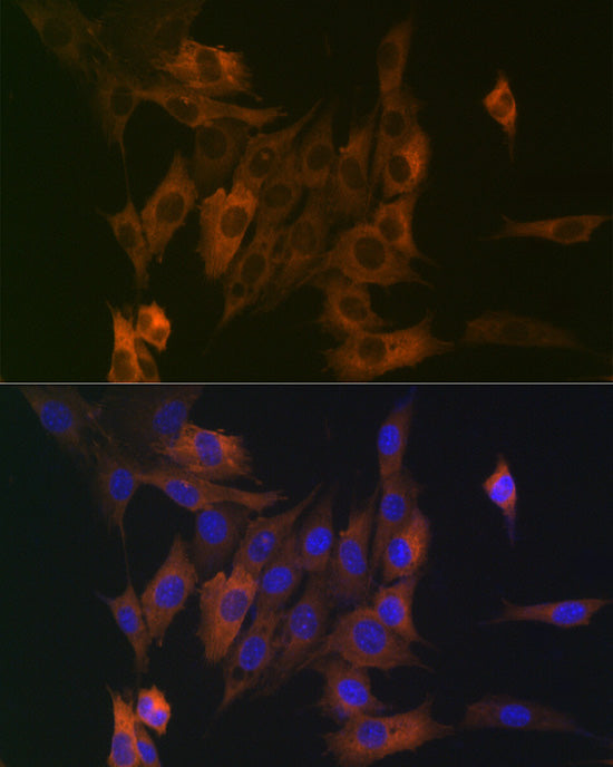 LPP Rabbit mAb