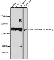 Eph receptor B3 (EPHB3) Rabbit mAb
