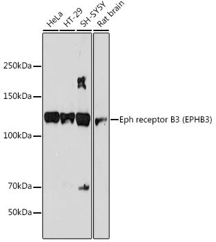 Eph receptor B3 (EPHB3) Rabbit mAb