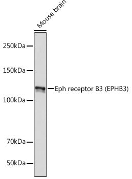 Eph receptor B3 (EPHB3) Rabbit mAb