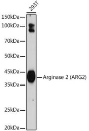 Arginase 2 (ARG2) Rabbit mAb