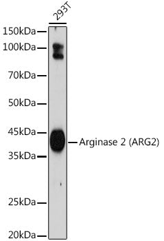 Arginase 2 (ARG2) Rabbit mAb