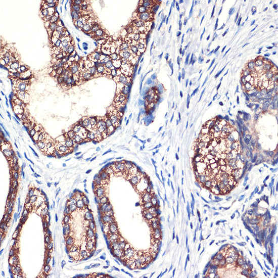 Arginase 2 (ARG2) Rabbit mAb