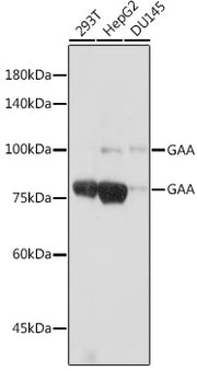 GAA Rabbit mAb