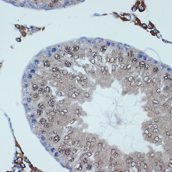 RanBP9 Rabbit mAb