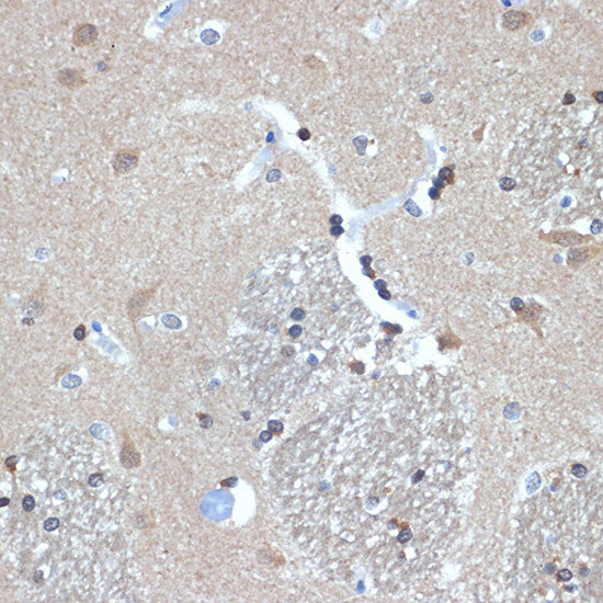 RanBP9 Rabbit mAb