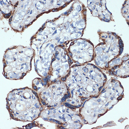 P4HB Rabbit mAb