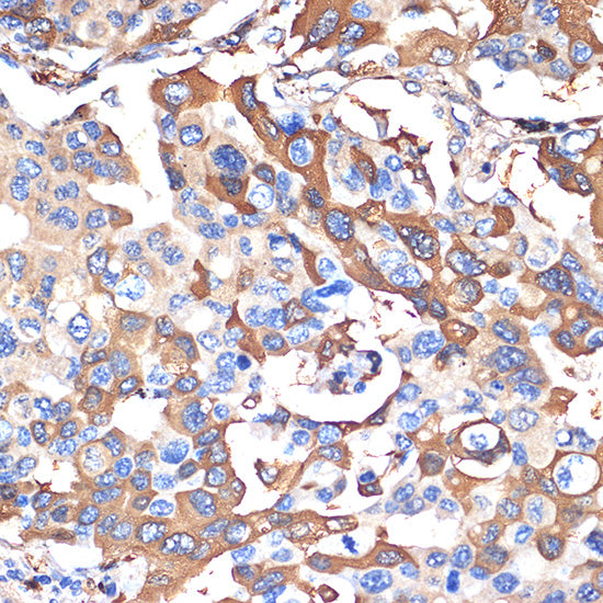 VPS28 Rabbit mAb