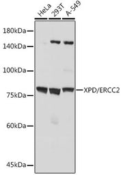 XPD/ERCC2 Rabbit mAb