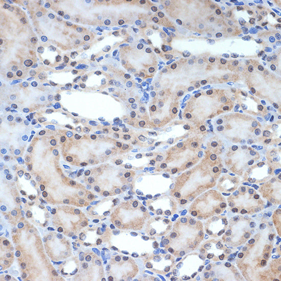 XPD/ERCC2 Rabbit mAb