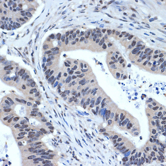 XPD/ERCC2 Rabbit mAb