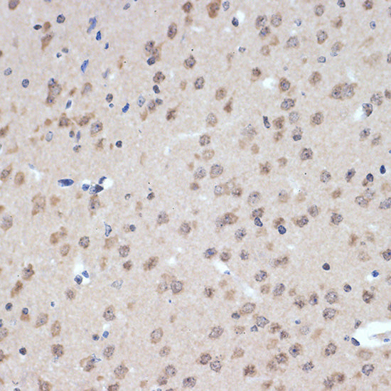 XPD/ERCC2 Rabbit mAb