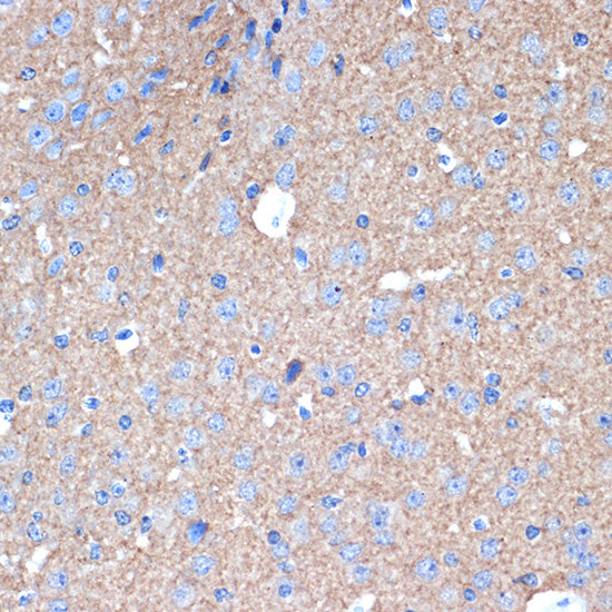 STX1A Rabbit mAb