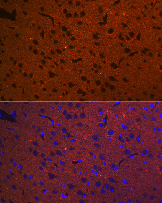 STX1A Rabbit mAb