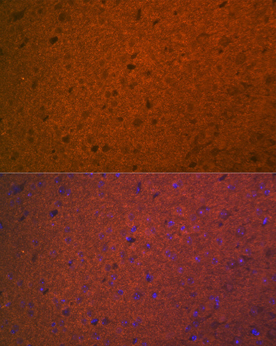 STX1A Rabbit mAb