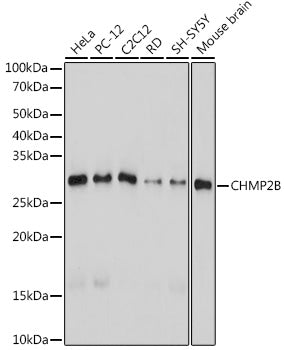 CHMP2B Rabbit mAb