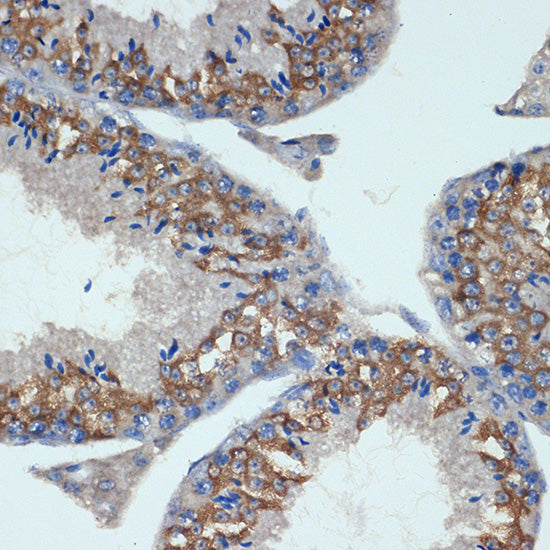 CHMP2B Rabbit mAb