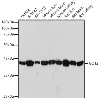 GOT2 Rabbit mAb