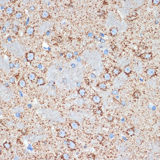 GOT2 Rabbit mAb